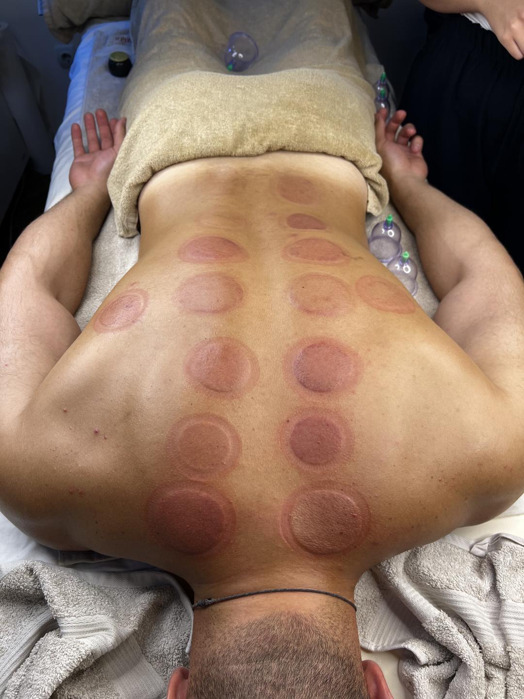 Zgodnica #beograd Tretmani tela Suva hidžama