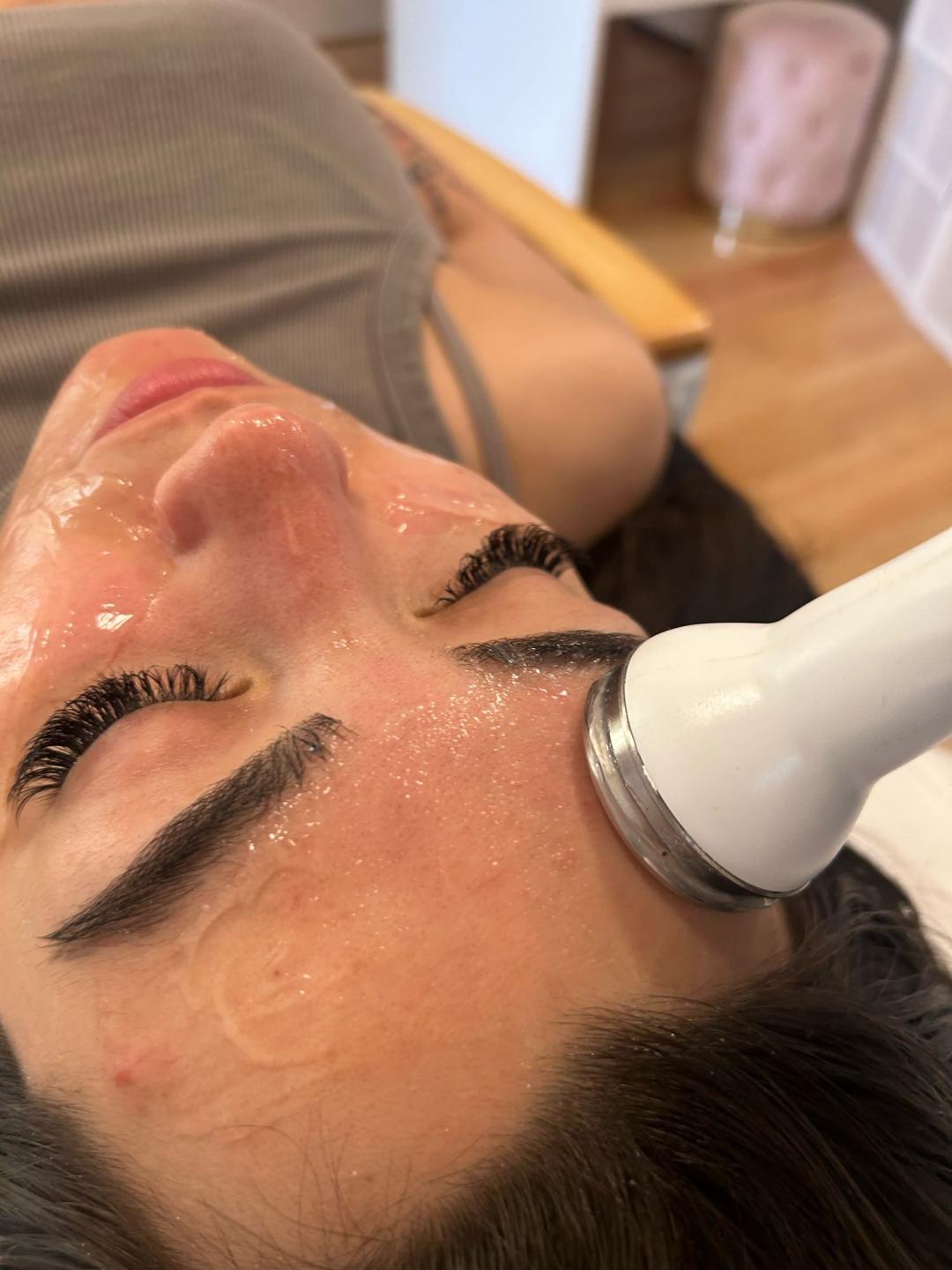 Esthetique Privé #beograd Tretman lica Klasican tretman lica + radiotalasni lifting