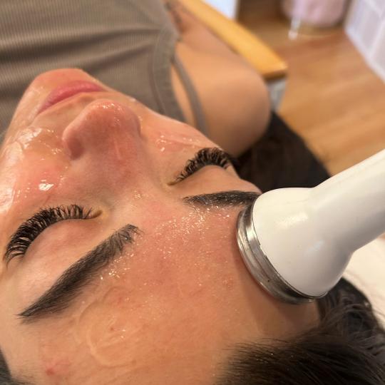 Esthetique Privé #beograd Tretman lica Klasican tretman lica + radiotalasni lifting