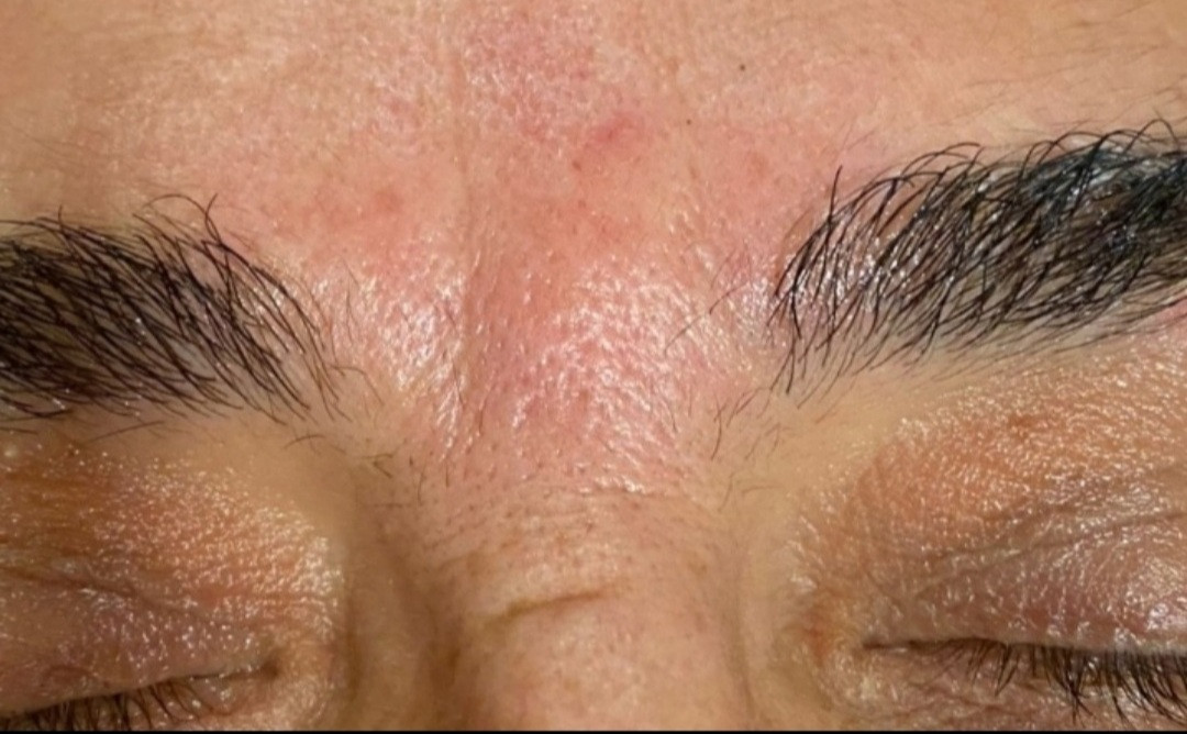 SunBox #beograd Masaža lica Face gym / Face fitness - anti age masaža lica