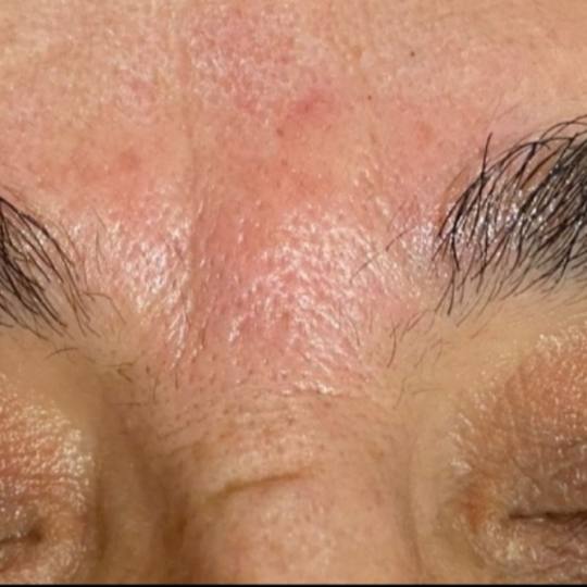 SunBox #beograd Masaža lica Face gym / Face fitness - anti age masaža lica