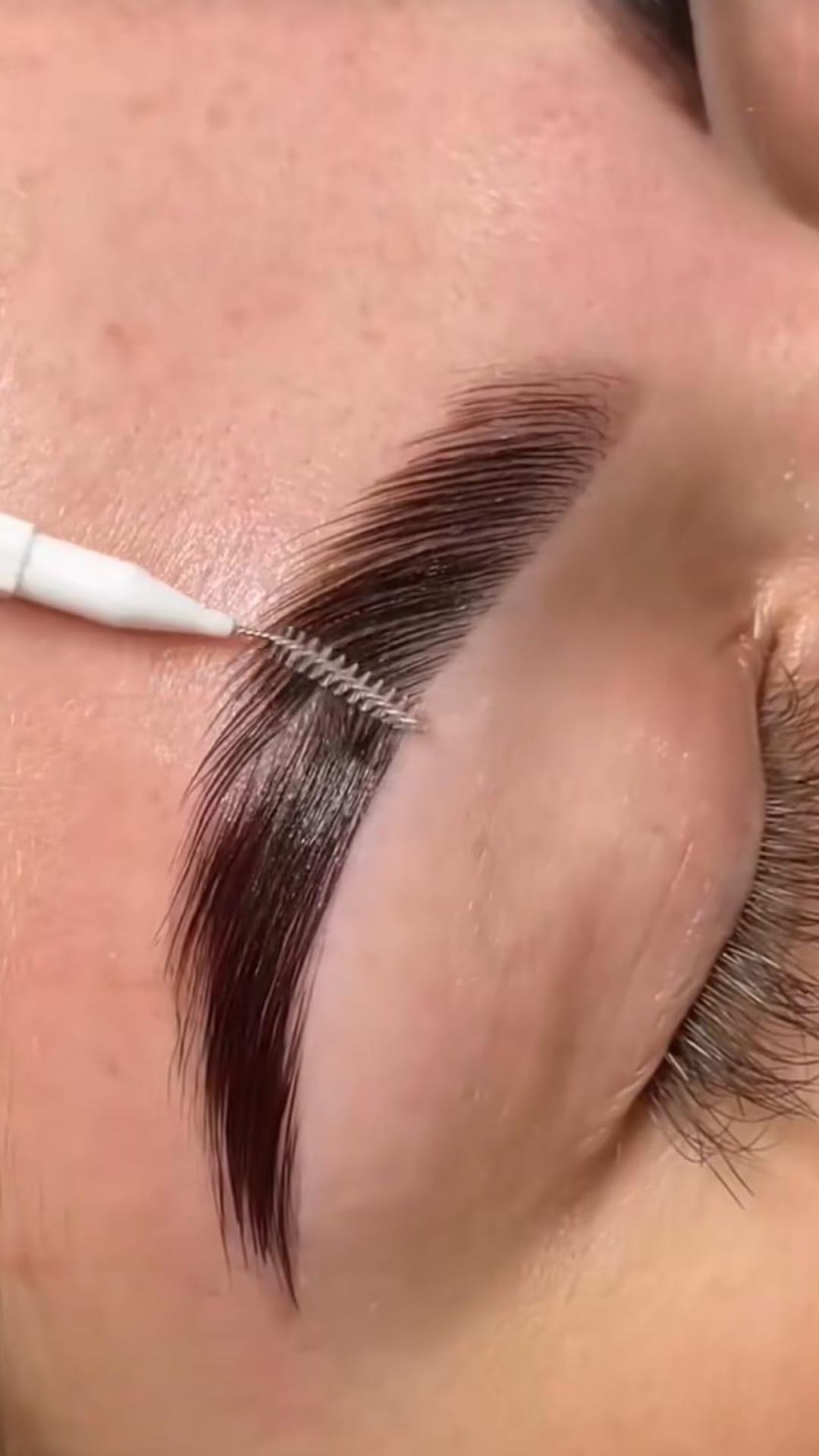 Brow lift - Esthetique Privé, Beograd Obrve Lice Obrve, Beograd, Centar, Stari grad, Dorćol