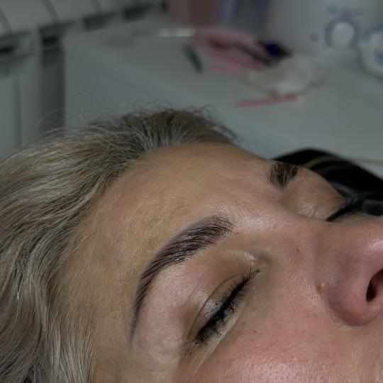 Studio Eleven Ladies&Gentlemen #beograd Obrve Brow lift