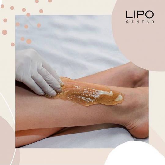 Lipo Centar #beograd Depilacija nogu Depilacija celih nogu šećernom pastom (ručna) - za dame