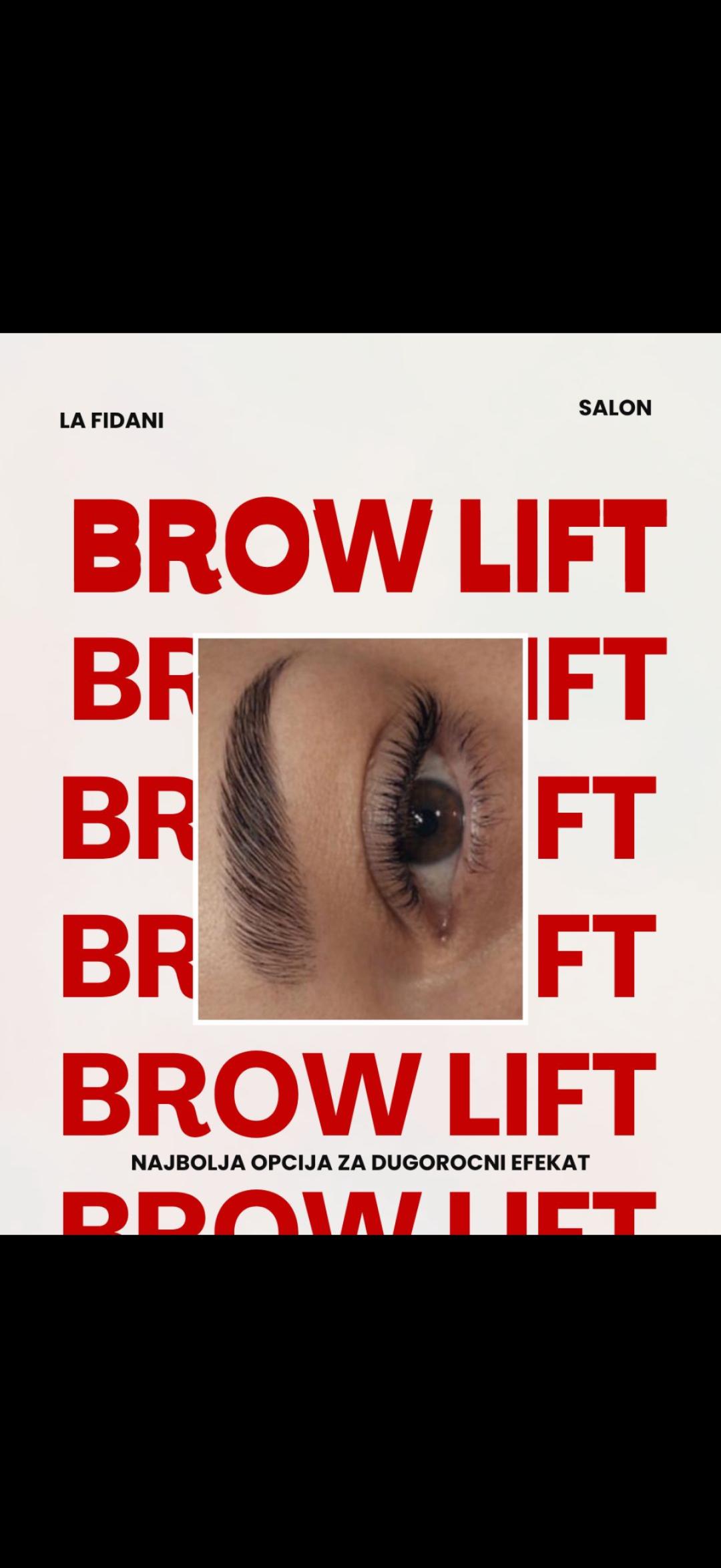 Brow lift - La Fidani, Niš Obrve Lice Obrve, Niš, Pantelej