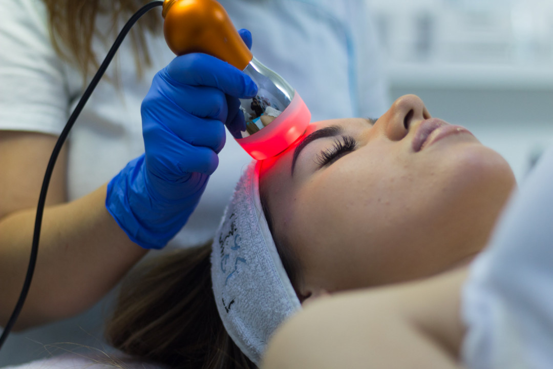 Sonnet beauty concept center #beograd Tretman lica Mezoporacija + radiotalasni lifting lica