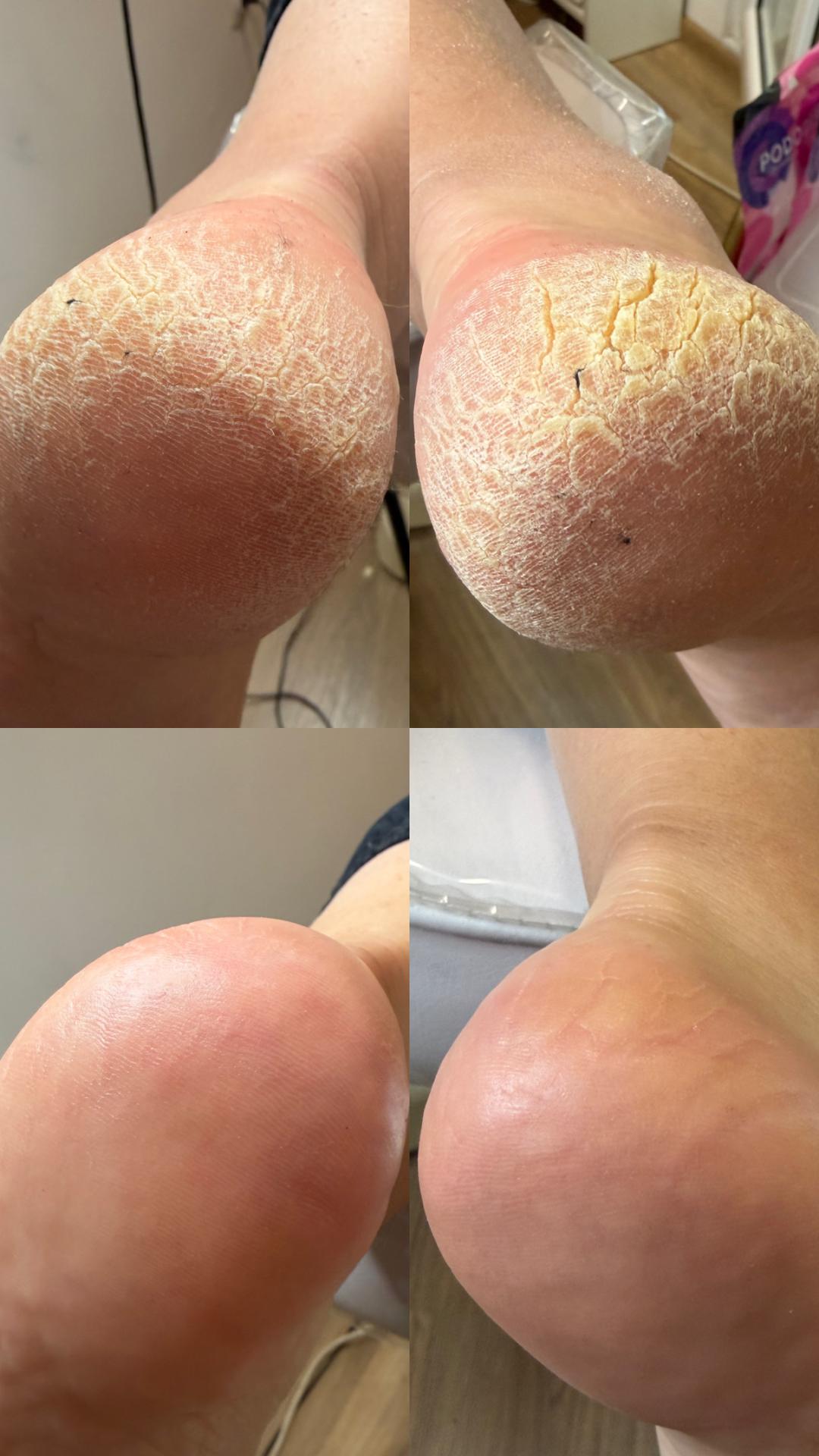 Elle beauty center #novisad Estetski pedikir SPA aparatni pedikir