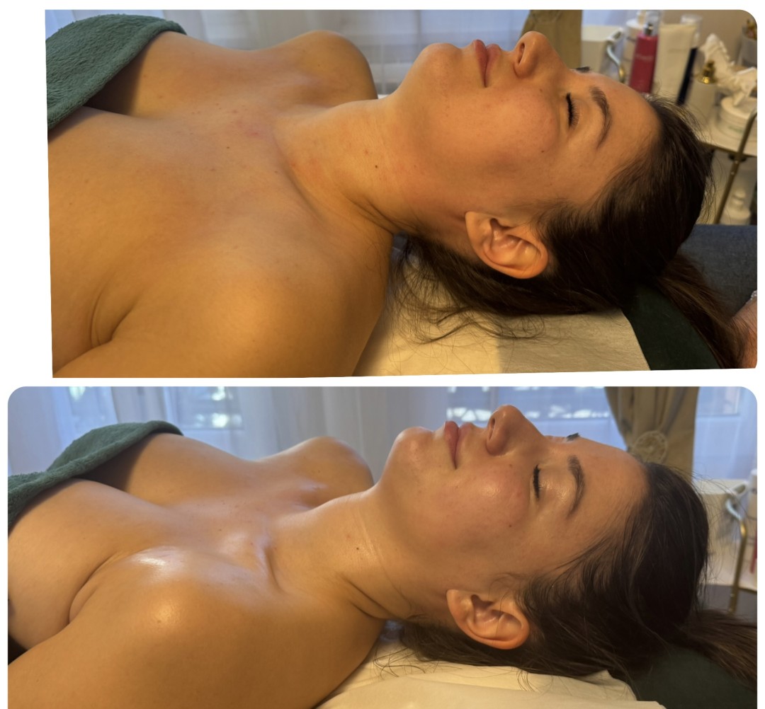 DIVINE Face masaža lica po metodi Manuele Shale - Beauty and nutrition, Beograd Lifting / zatezanje kože Lice Lifting / zatezanje kože, Beograd, Zvezdara