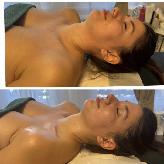 Beauty and nutrition #beograd Lifting / zatezanje kože DIVINE Face masaža lica po metodi Manuele S