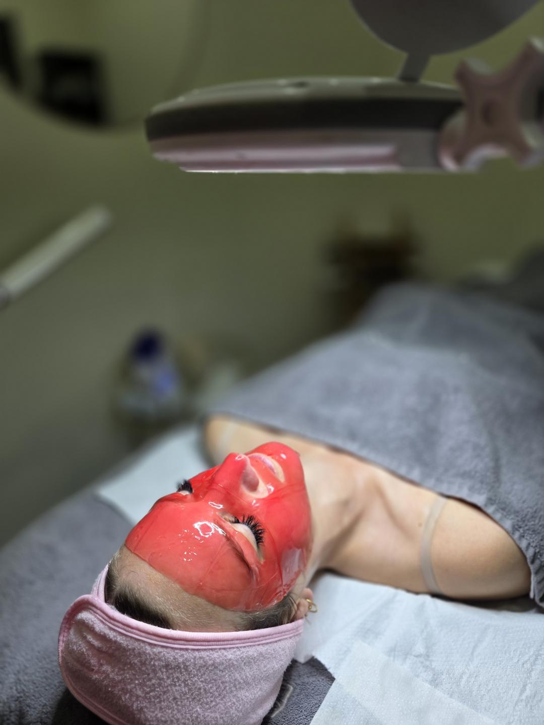 Dermapen tretman lica - Starmedic, Beograd Dermaroler i dermapen Lice Dermaroler i dermapen, Beograd, Vračar, Čubura, Crveni krst