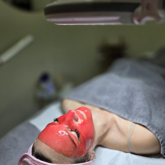 Starmedic #beograd Dermaroler i dermapen Dermapen tretman lica