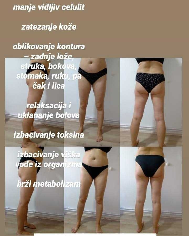 Maderoterapija - Krasiva, Beograd Anticelulit masaža Masaža Anticelulit masaža, Beograd, Novi Beograd Ušće, Sava Centar
