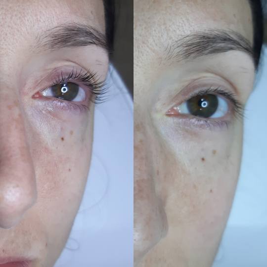 Tag Beauty Bar #beograd Trepavice Lash lift na kratkim i tankim trepavicama Lash lift + botox trepav