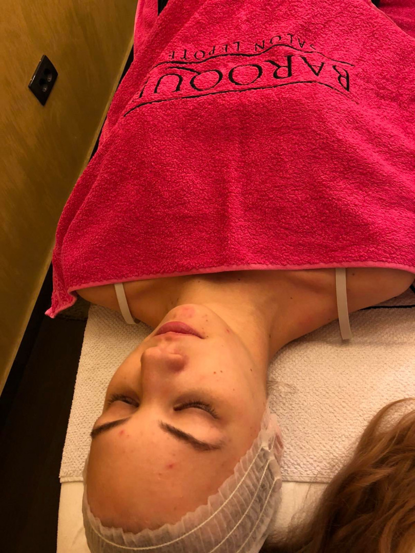Baroque #beograd Dermaroler i dermapen Dermapen lica + vrata + dekoltea