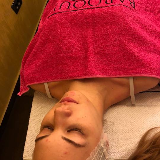 Baroque #beograd Dermaroler i dermapen Dermapen lica + vrata + dekoltea