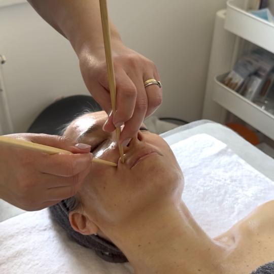 Lola esthetic center #beograd Tretman lica Multi vita - vitaminski antiage tretman 60+