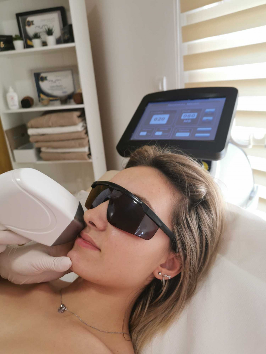 D&D Beauty Center #beograd Laserska epilacija Laserska epilacija nausnica - za dame
