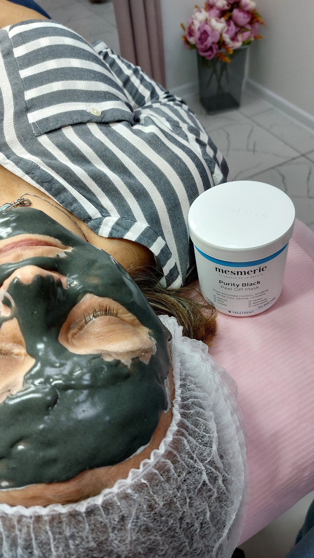 Andromeda Beauty Studio #beograd Tretman lica Medicinski tretnan lica - manje zahtevan