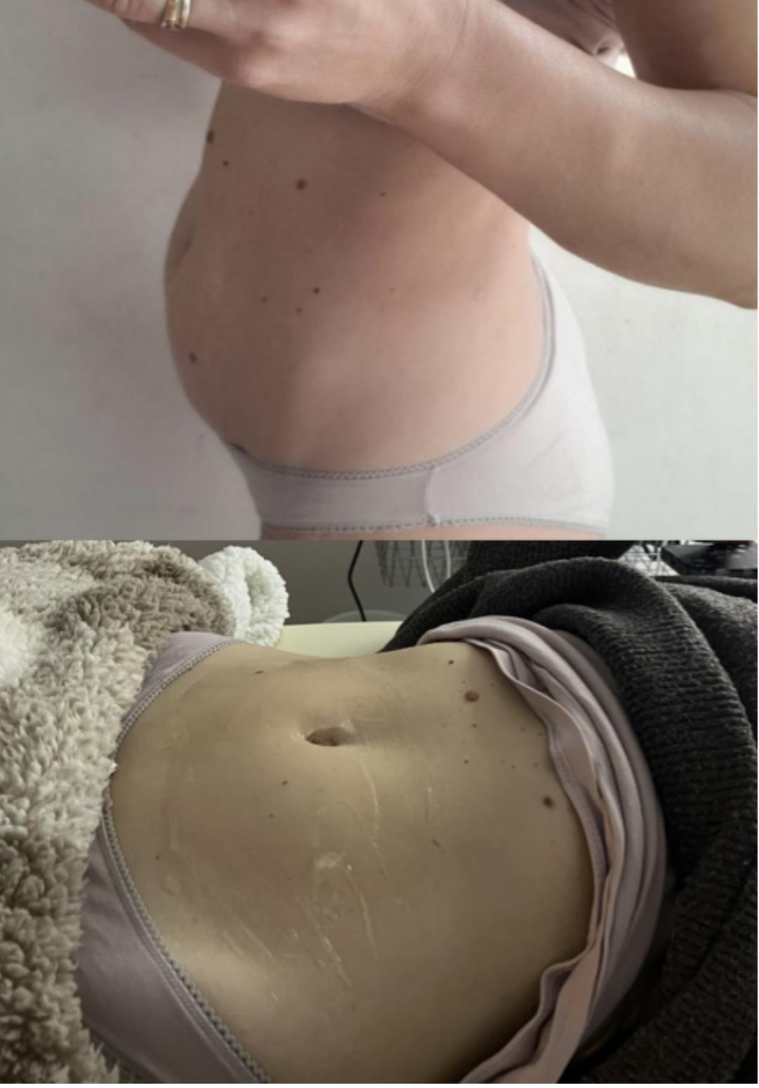 Amelini beauty concept #beograd Tretmani tela Kavitacija + EMS - 30 minuta