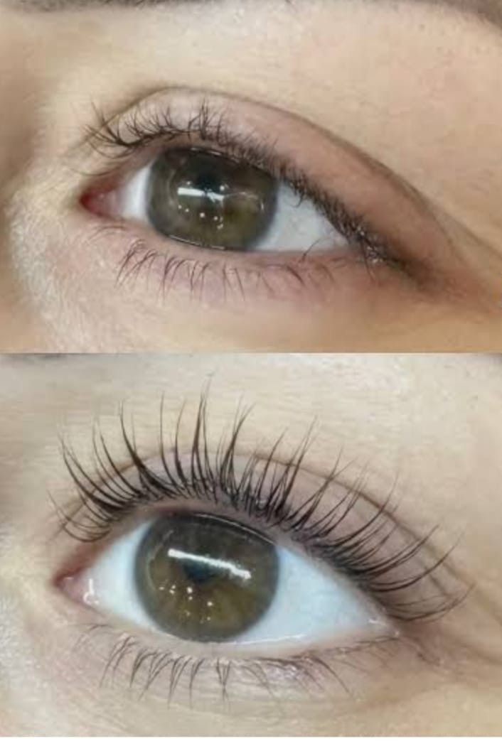 Let's go Ladies #beograd Trepavice Lash lift + farbanje trepavica + Botox