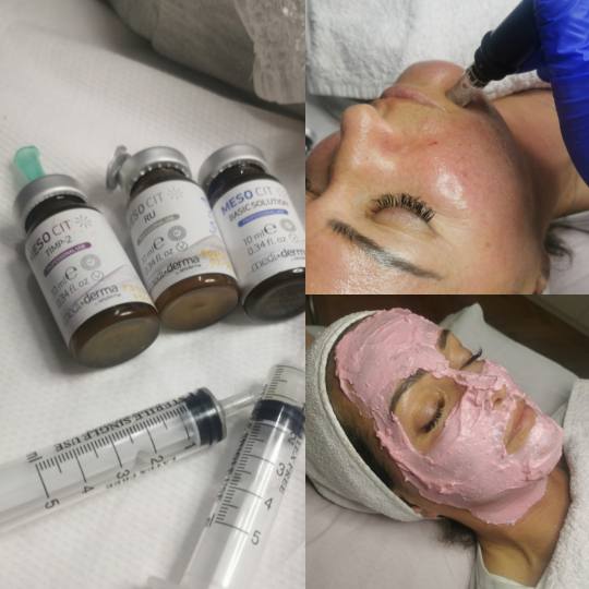 Platinum Beauty Code #beograd Tretman lica Dermapen, tretman mezoterapije Mezoperapija dermapenom