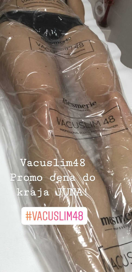 Esthetic Studio Irena #beograd Tretmani za mršavljenje