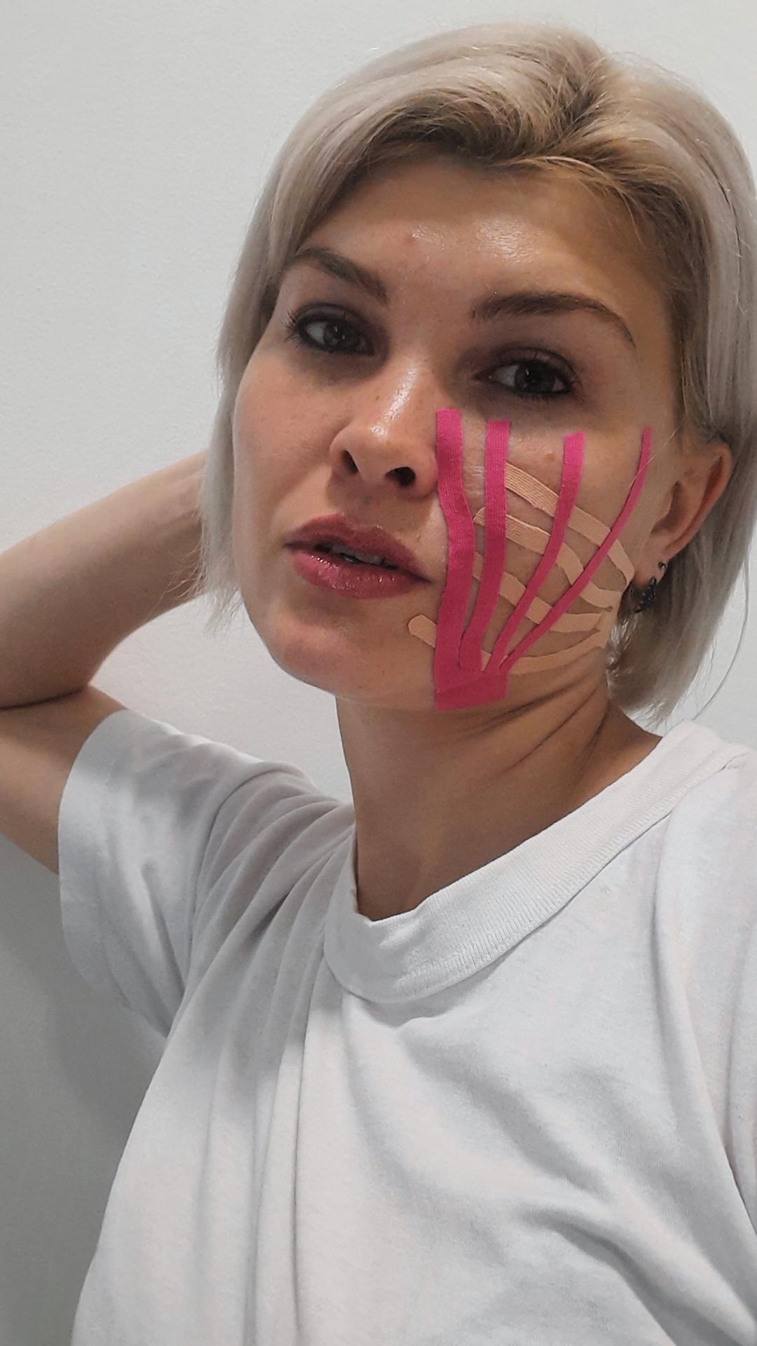 Kineziotejping lica (estetsko tejpovanje) - Beauty Lab Ženska Tajna, Novi Sad Tretman lica Lice Tretman lica, Novi Sad, Grbavica, Liman, Adamićevo