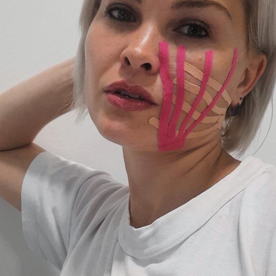 Beauty Lab Ženska Tajna #novisad Tretman lica Kineziotejping lica (estetsko tejpovanje) Face taping