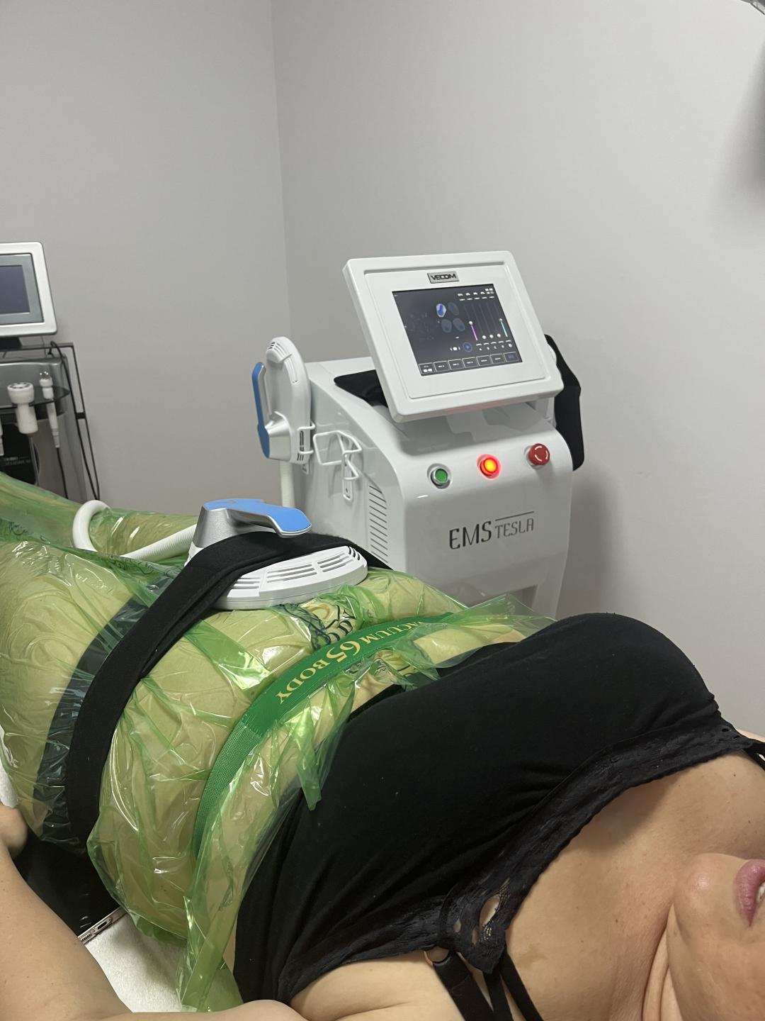 Amelini beauty concept #beograd Tretmani tela Vacuum 65 body + EMS tesla