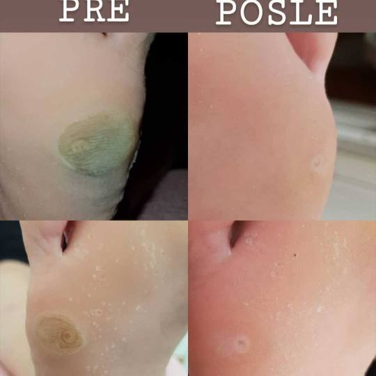 Just You Beauty & Nails #beograd Medicinski pedikir
