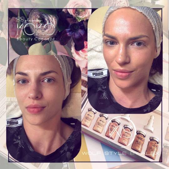 Studio Crystal by Sandra #beograd Tretman lica