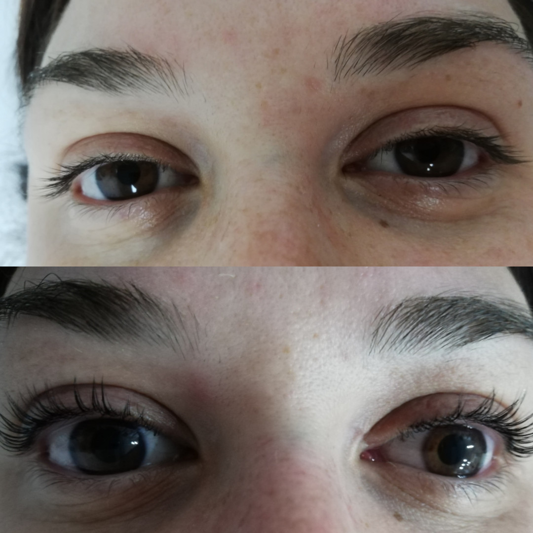 Be YOU tiful #novisad Trepavice Lash lifting + botox