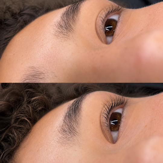 MiViDa Beauty System usluga