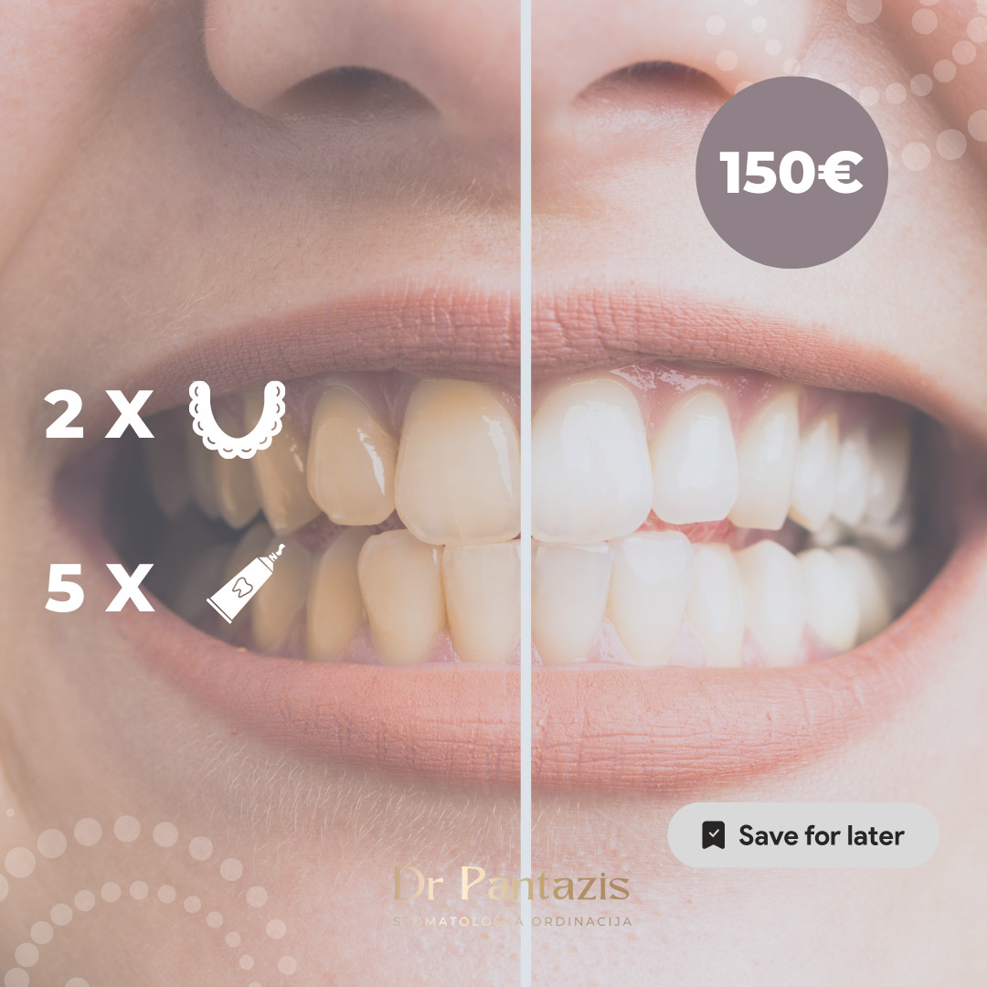 Dr Pantazis - Dental & Beauty Clinic #beograd Zubi Kućno Izbeljivanje Zuba | set folije & gelovi