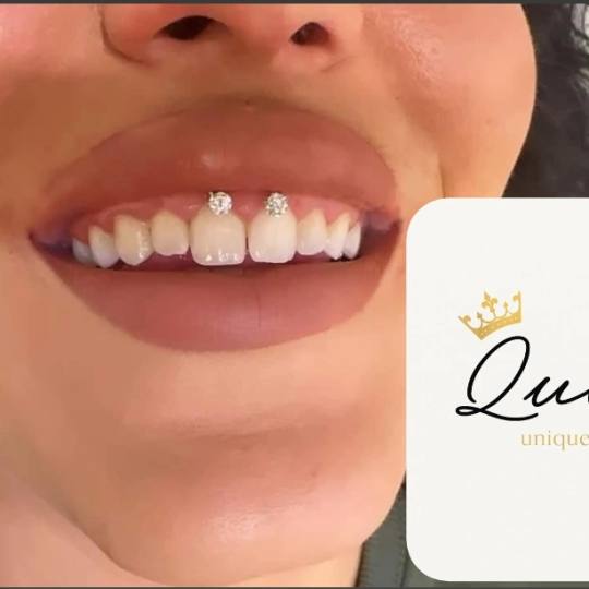 Queen #beograd Ostalo Pirsing - smiley Wellness