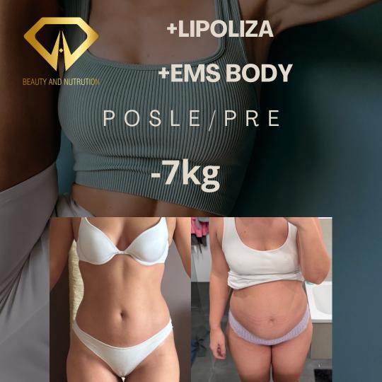 Beauty and nutrition usluga