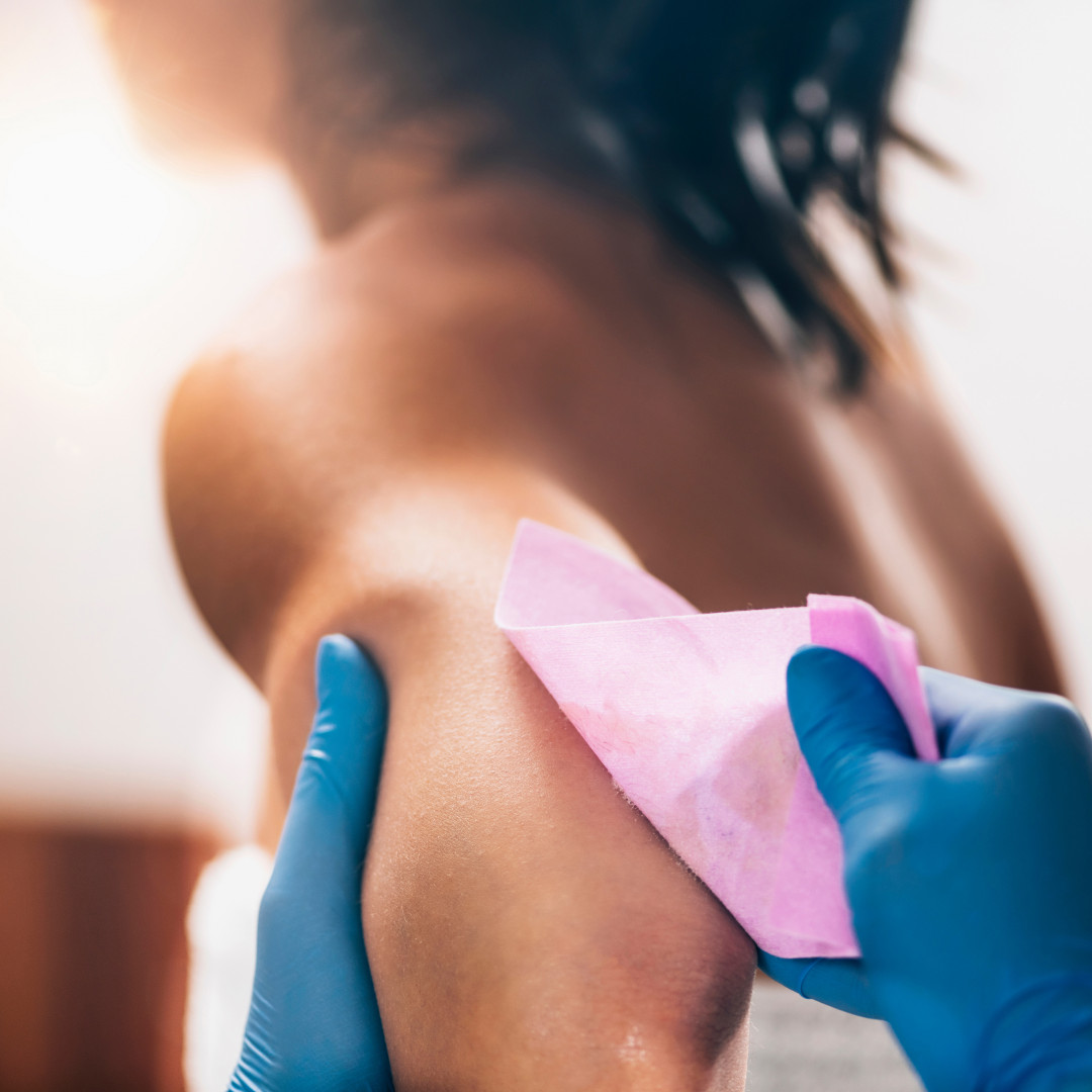 Depilacija celih ruku hladnim voskom - za dame - PJ Health & Beauty Center, Beograd Depilacija ruku Depilacija Depilacija ruku, Beograd, Centar, Stari grad, Dorćol