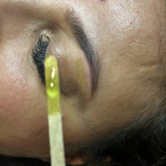 Ks Laser Beauty Centar #beograd