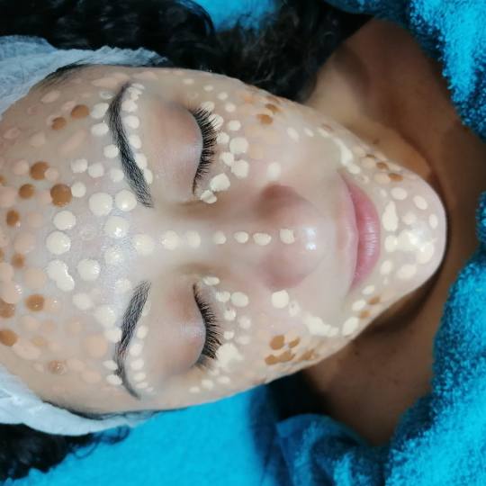 Brankica beauty artist #beograd Dermaroler i dermapen