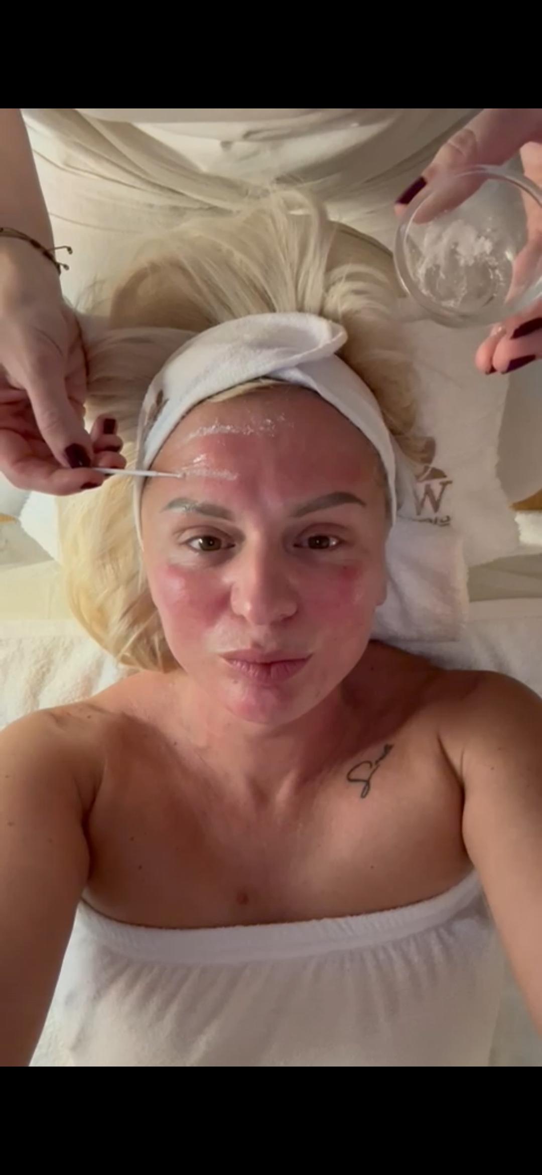 Dermapen microneedling tretman lica;lica,vrata i dekoltea - Glow Holistic Studio, Beograd Dermaroler i dermapen Lice Dermaroler i dermapen, Beograd, Novi Beograd blokovi, Belville, Savski kej