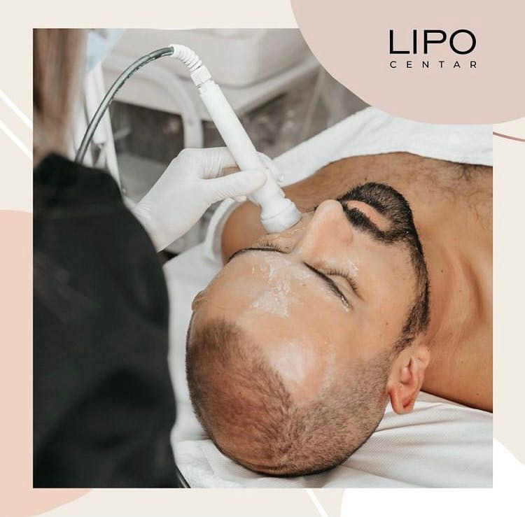 Mezoporacija - lice + vrat + dekolte - Lipo Centar, Beograd Tretman lica Lice Tretman lica, Beograd, Zvezdara