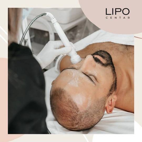 Lipo Centar #beograd Tretman lica Mezoporacija - lice + vrat + dekolte