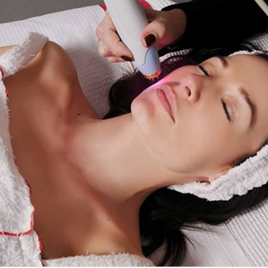 Grossi cosmetic #beograd Lifting / zatezanje kože