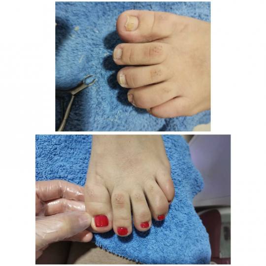 Krasiva #beograd Estetski pedikir Estetski pedikir + gel lak( boja, french)