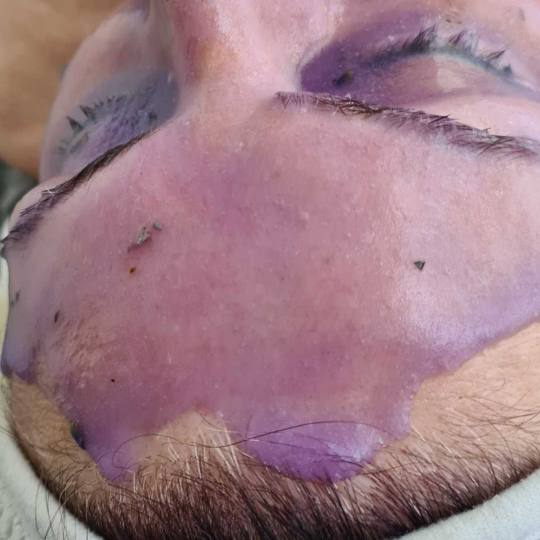 SunBox #beograd Masaža lica Soft Spa tretman lica i vrata - paket od 3 tretmana Antiage efekat, mas