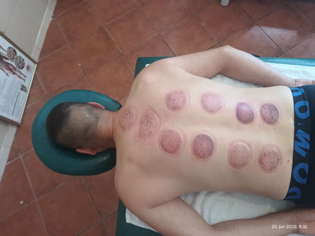 Relax body centar #zajecar Masaža teglama Mokra hidžama