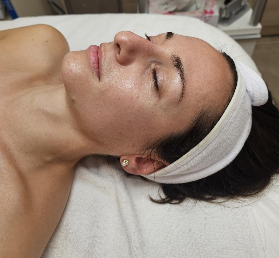 Choco Love #beograd Tretman lica Tretman lica egzozomima