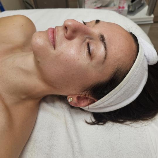 Choco Love #beograd Tretman lica Tretman lica egzozomima Šta je tretman egzosomima?
To je terapija