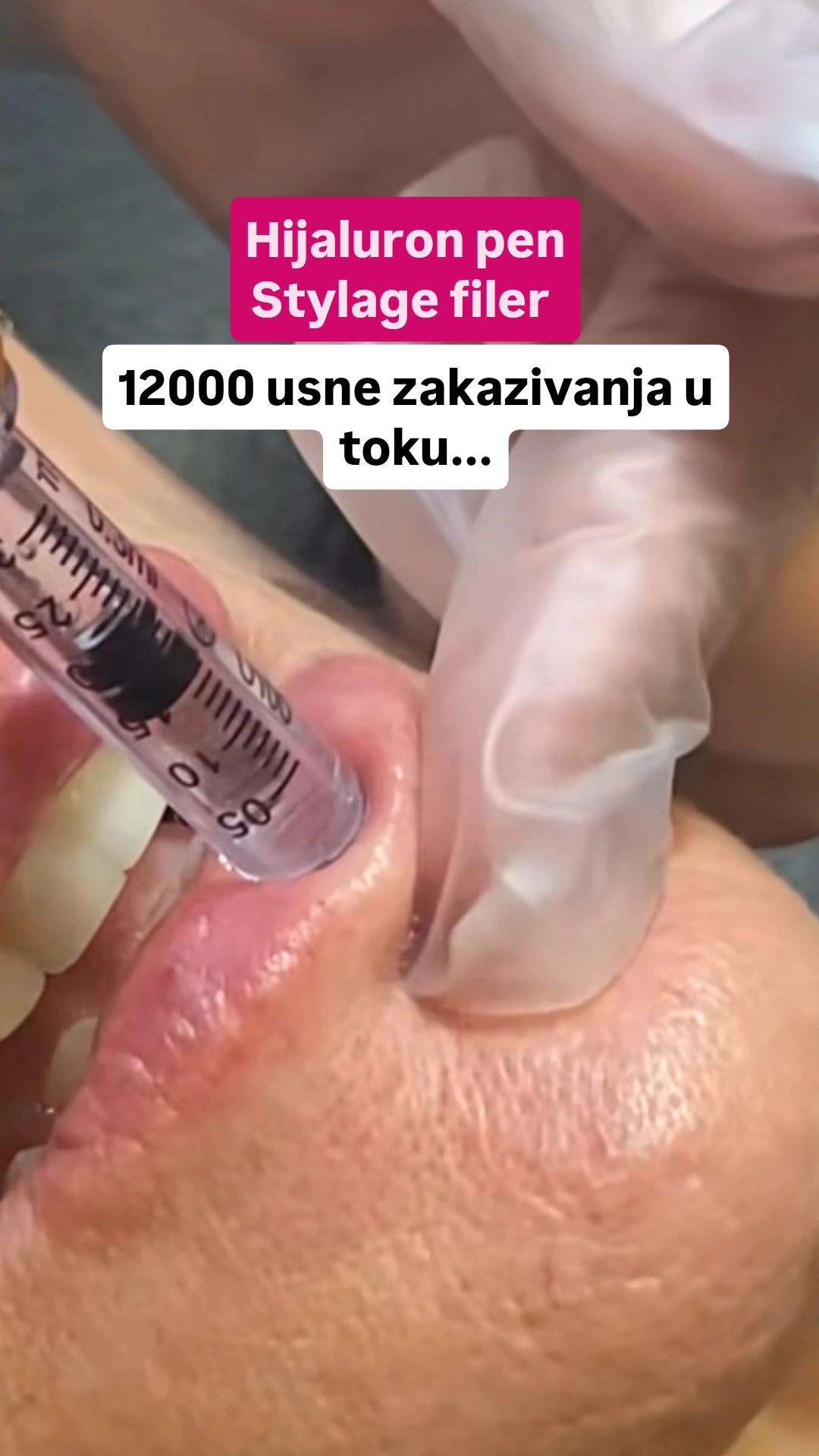 Professional beauty and spa #beograd Trajna šminka Trajna šminka usne - full lips