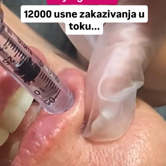 Professional beauty and spa #beograd Trajna šminka Trajna šminka usne - full lips Usne plus liftin